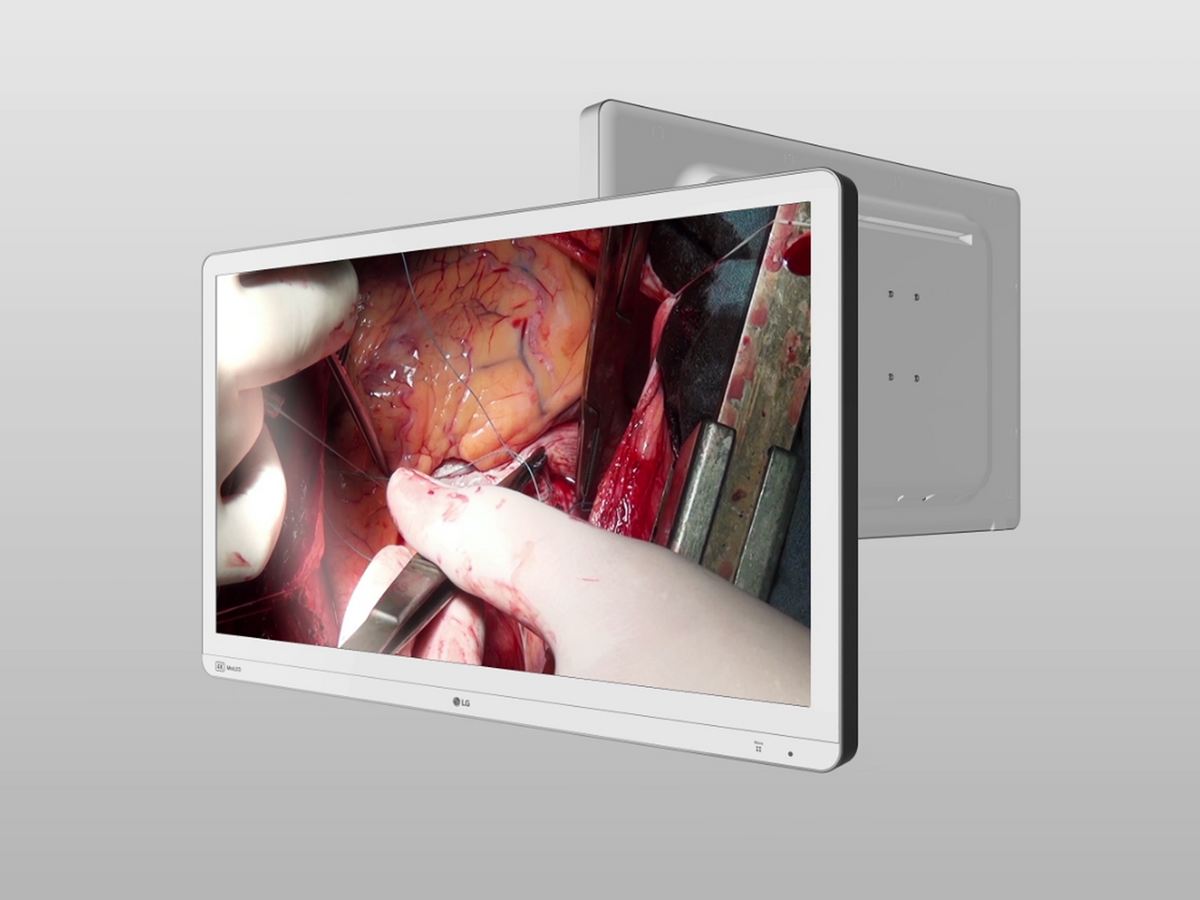 LG’s New 32HR734S 4K Surgical Monitor With Mini LED Technology Delivers Outstanding Image Quality