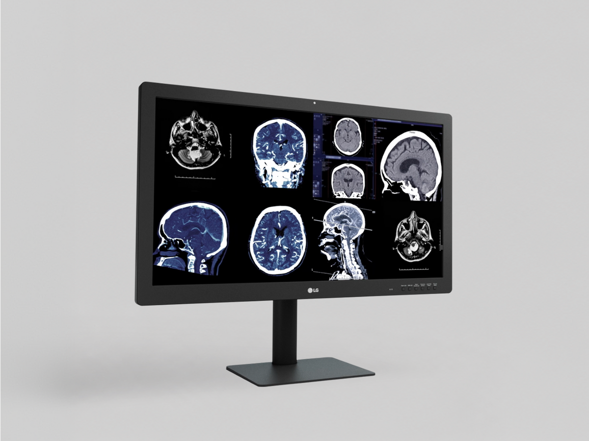 LG’s New Diagnostic Monitor With IPS Black Delivers Reliable Image Quality