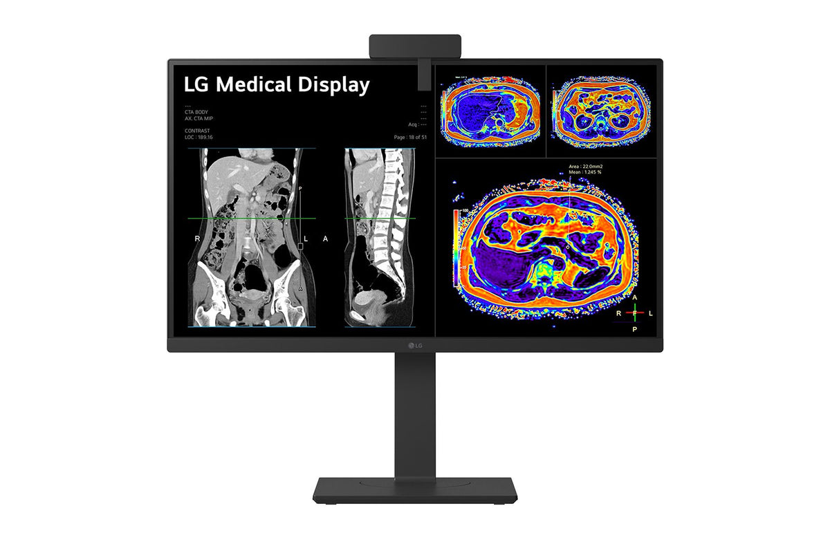 LG 27” 8MP IPS Clinical Review Monitor
