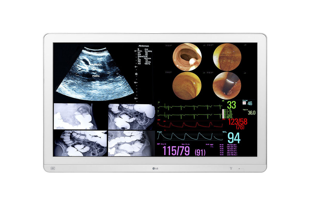 LG 31.5" 4K IPS Surgical Monitor