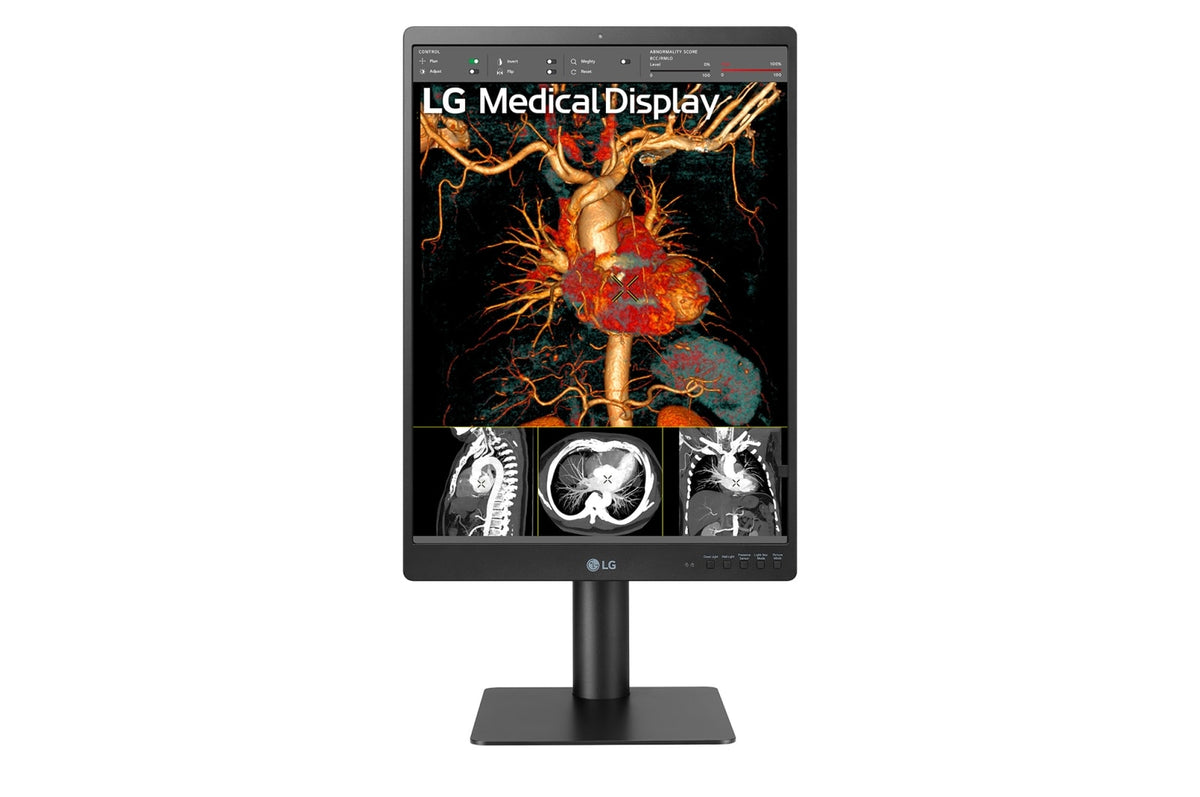 LG 21.3'' 3MP IPS Diagnostic Monitor