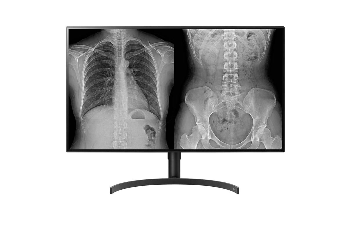LG 8MP Diagnostic Monitor
