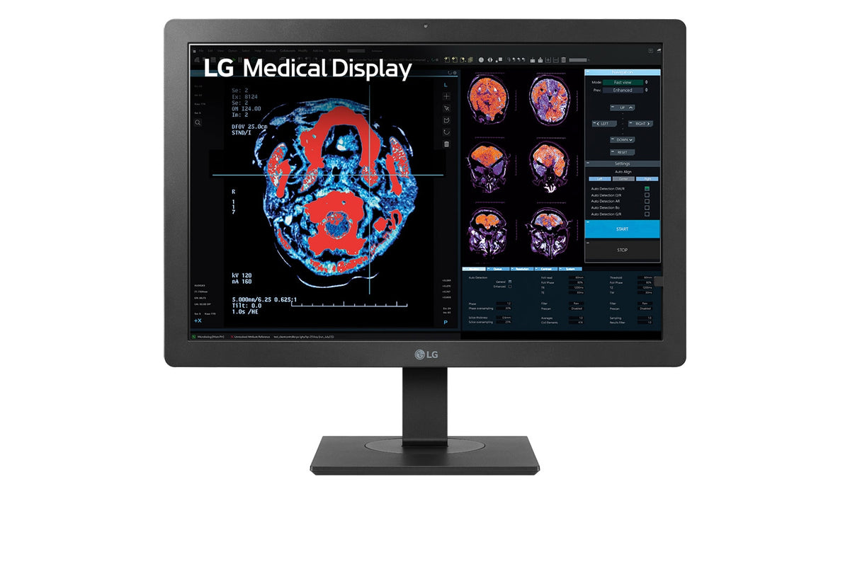 LG 24” 2MP IPS Clinical Review Monitor