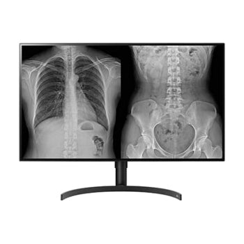 31.5-inch 8MP IPS Diagnostic Monitor